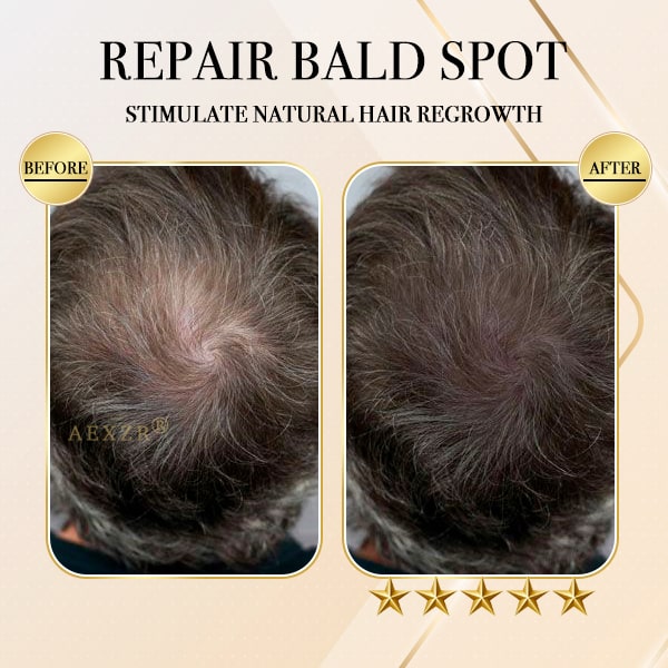 Aexzr® Ginger Hair Regrowth Shampoo Bar